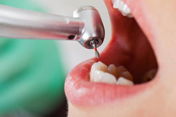 Best Emergency Gum Treatment in Jellico, TN